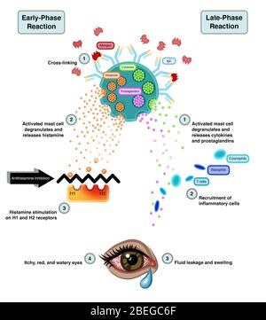Allergic Cascade Illustrated Flow Chart Stock Photo Alamy