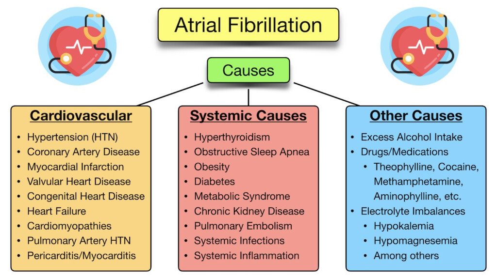 Atrial Fibrillation Symptoms ECG Causes Treatment 45 OFF