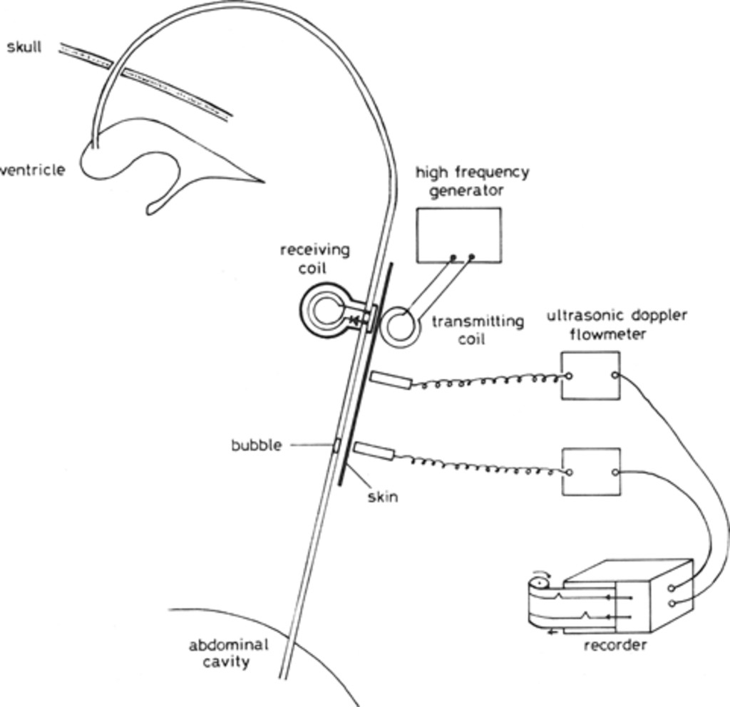 Cerebrospinal Fluid Flow Chart A Visual Reference Of Charts Chart Master