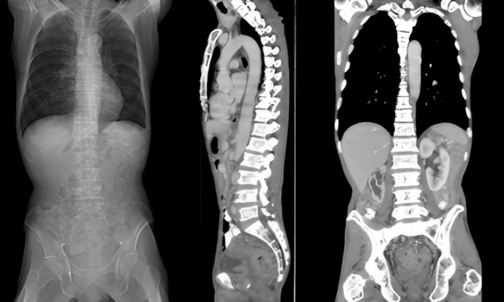 CT Scan Spine Kiran Lab