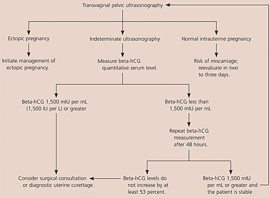 Ectopic Pregnancy Algorithm