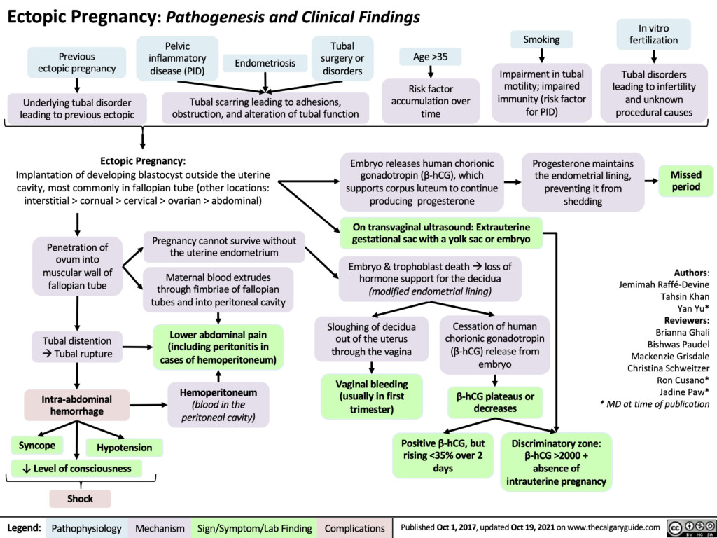 Ectopic Pregnancy Calgary Guide