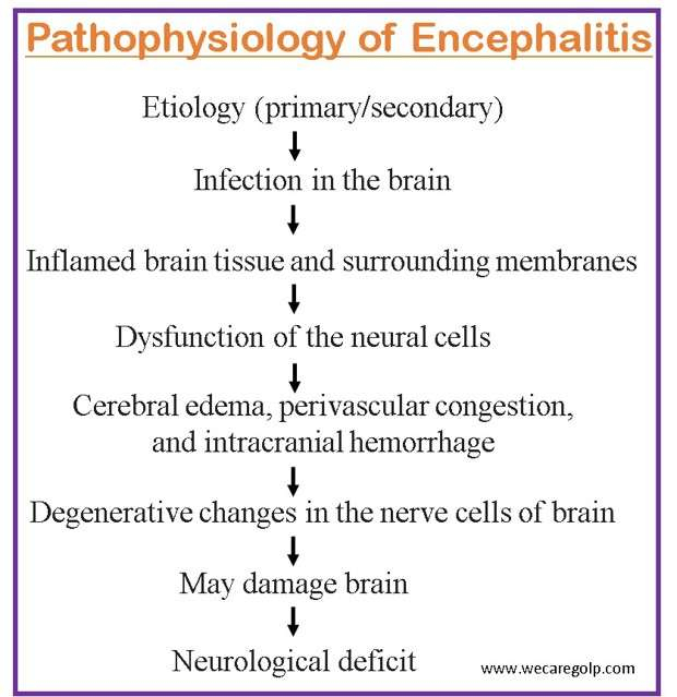 Encephalitis Causes Treatment Prevention We Care