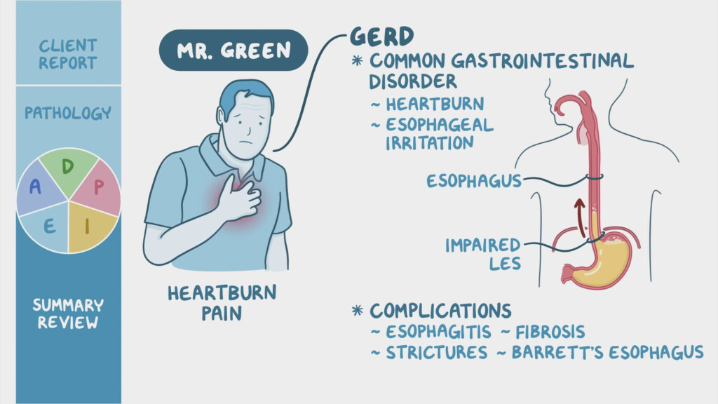 Gastroesophageal Reflux Disease GERD Nursing Process ADPIE 