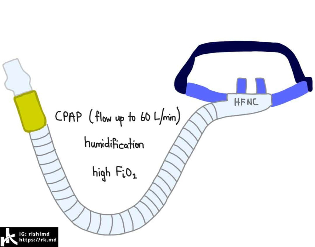 High Flow Nasal Cannula FiO2 Chart