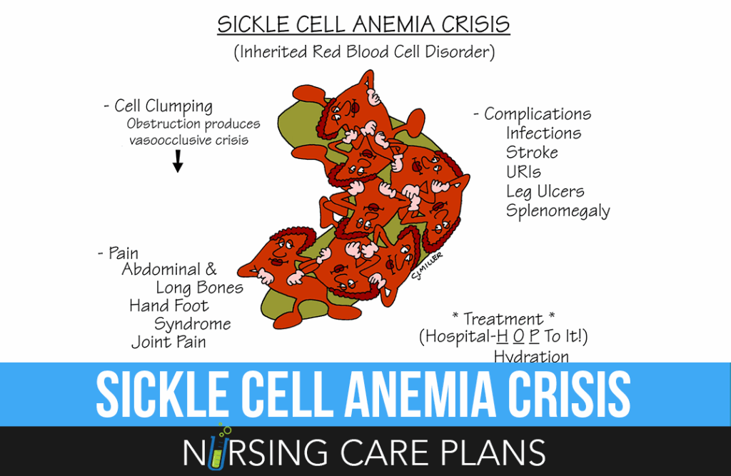Sickle Cell Anemia Ppt For Nurses