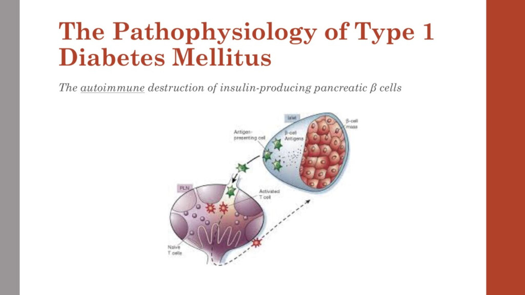 Type One Diabetes Mellitus Pathophysiology Diabetes Pathophysiology 